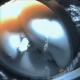 A camera installed beneath an outhouse opening records a girl pissing, shitting and then wiping her ass. No audio, but nice voyeur scene. Over a minute.